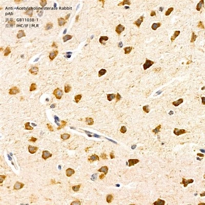 Anti-Acetylcholinesterase Rabbit PAb
