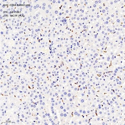 Anti-CD68 Rabbit PAb