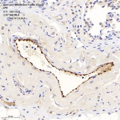 Anti-Von Willebrand Factor Rabbit PAb