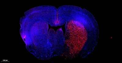 TMR (Red) Tunel Cell Apoptosis Detection Kit